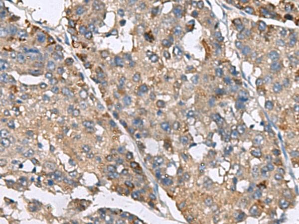 IP6K2 Antibody