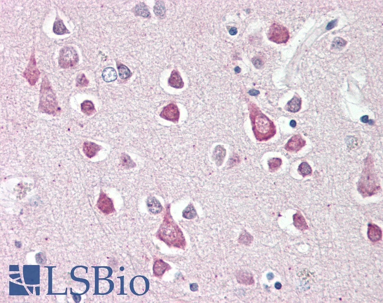 PathPlus™ Polyclonal Rabbit anti-Human ABCA4 Antibody (C-Terminus, IHC)