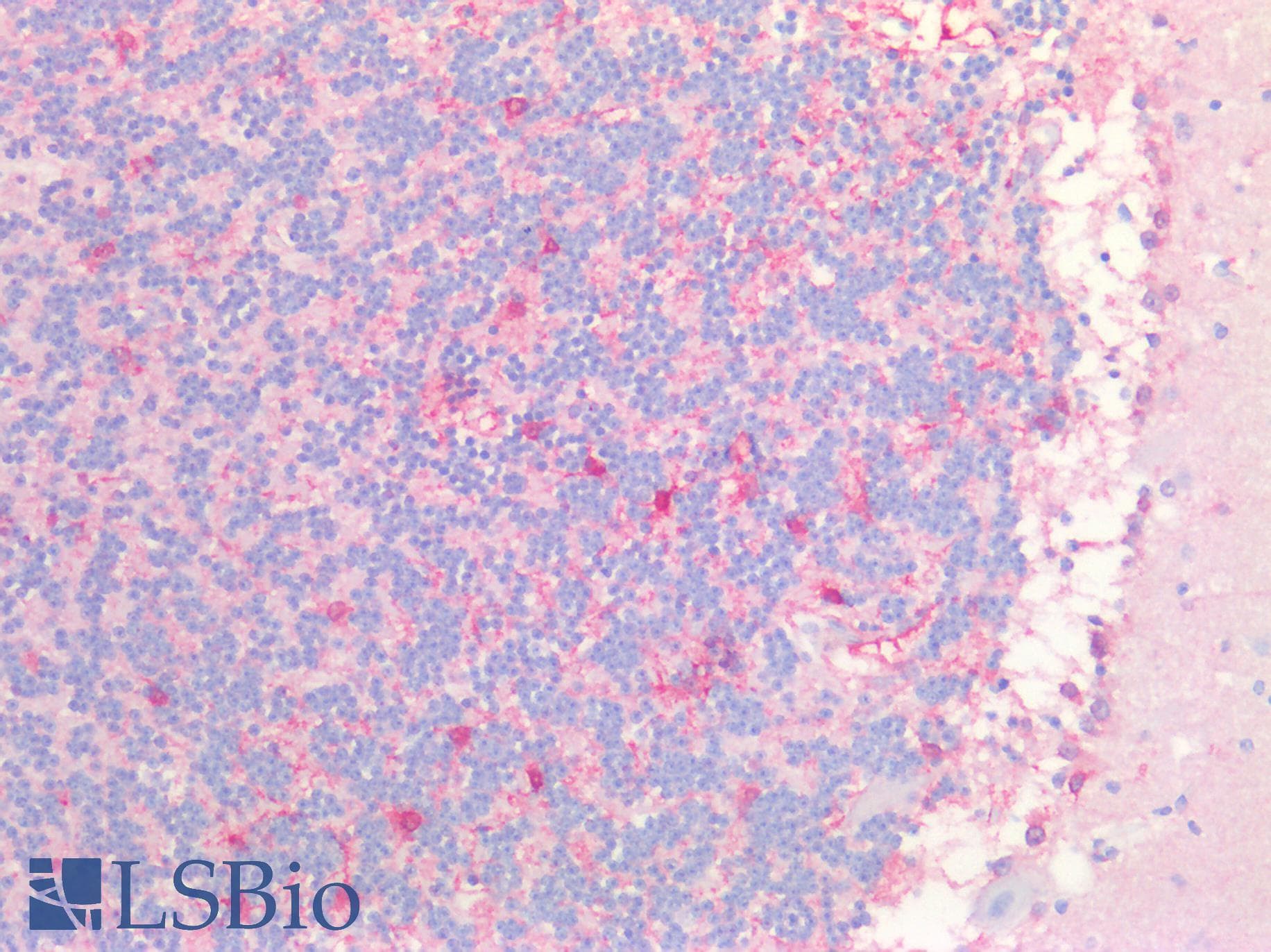 PathPlus™ Monoclonal Mouse anti-Human GLUL / Glutamine Synthetase Antibody (clone AT8D7, IHC, IF, WB)