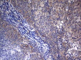 STK11 / LKB1 Antibody (aa1-236, clone OTI0A3)