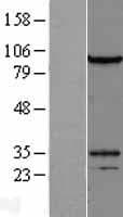 DZIP1L Protein (Over-Expression Lysate Myc-DDK (Flag))