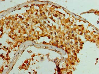 Polyclonal Rabbit anti-Human KDM1A / LSD1 Antibody (IHC, IF, WB)