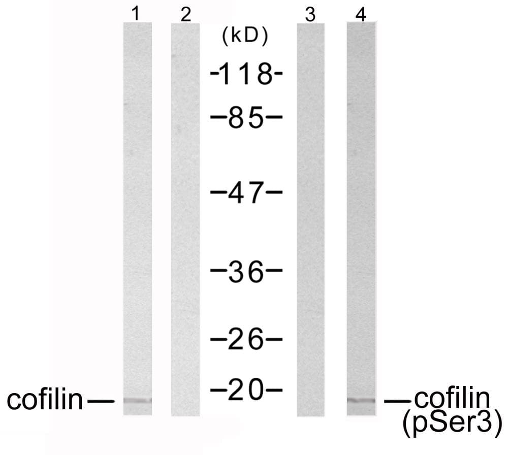 CFL1 / Cofilin Antibody (p3)