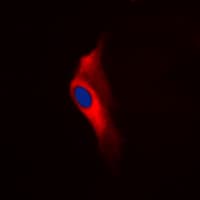 PRKCE / PKC-Epsilon Antibody (C-Terminus)
