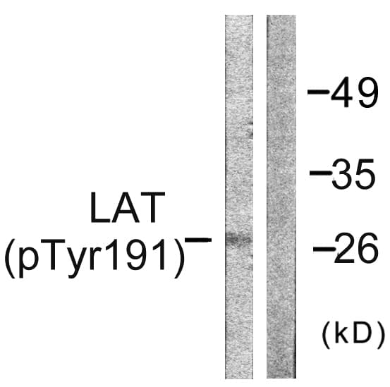 Polyclonal Rabbit anti-Human LAT Antibody (phospho-Tyr191, IHC, WB)