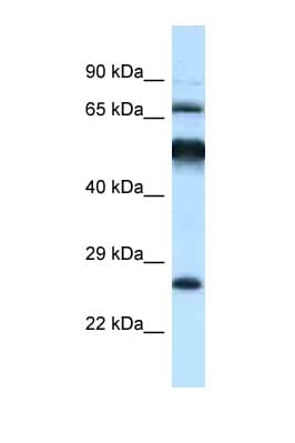 Polyclonal Rabbit anti-Rat KLHL1 Antibody (aa396-445, WB)