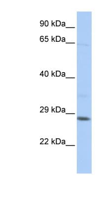 TGIF2LX Antibody (C-Terminus)