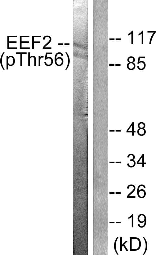 EEF2 / Elongation Factor 2 Antibody (phospho-Thr56)