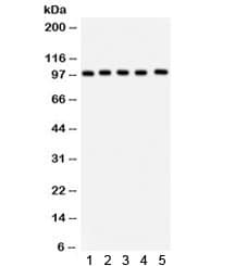 Polyclonal Rabbit anti-Human Junctin / ASPH Antibody (IHC, WB)
