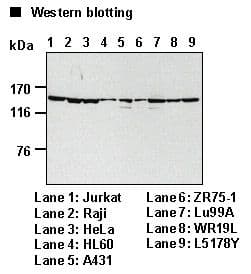 SF3B1 Antibody (clone 16)