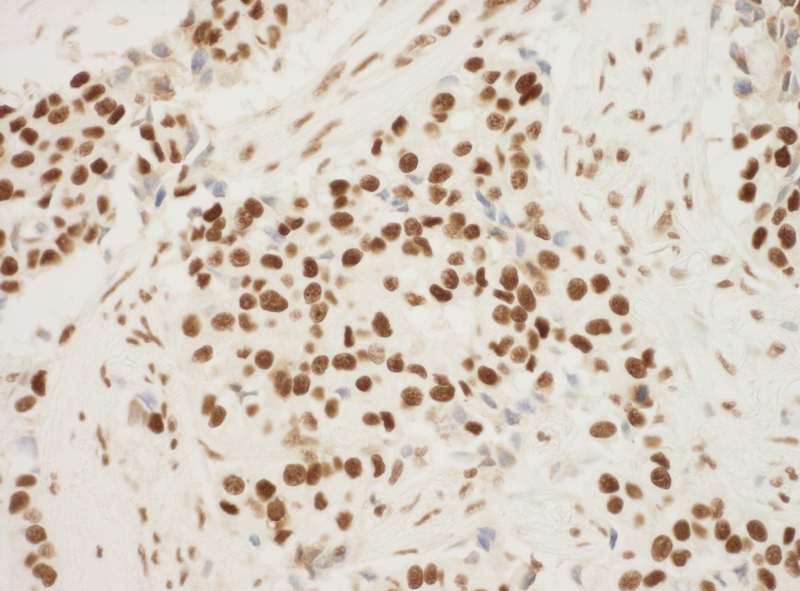 NPM1 / NPM / Nucleophosmin Antibody (aa250-294)