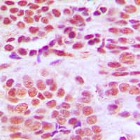 Polyclonal Rabbit anti-Human HDAC1 Antibody (C-Terminus, IHC, IF, WB)