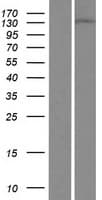 DGKD Protein (Over-Expression Lysate Myc-DDK (Flag))