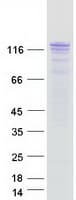 Human ESYT1 Protein (Recombinant Myc-DDK (Flag))