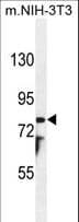 PTCHD1 Antibody (aa611-639)
