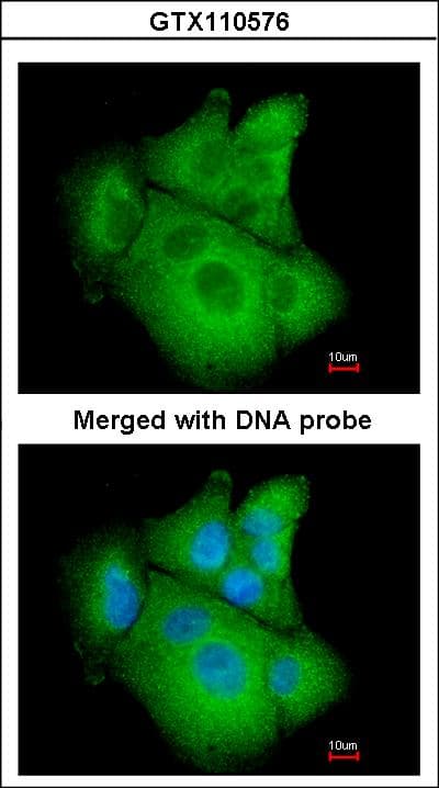 IHC-plus™ Polyclonal Rabbit anti-Human PSAT1 Antibody (aa48-328, IHC, WB)