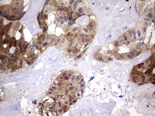 LGALS3 / Galectin 3 Antibody (clone OTI1C7)