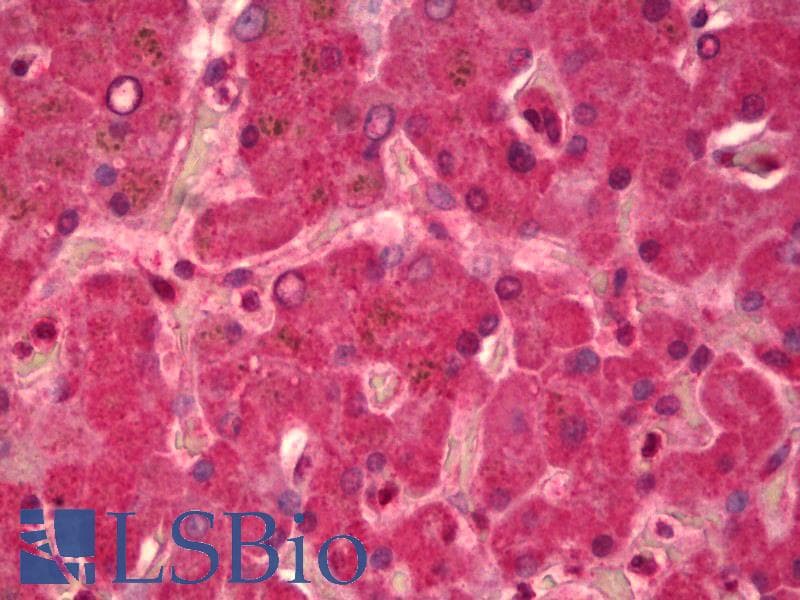 IHC-plus™ Polyclonal Rabbit anti-Human Alpha-Fetoprotein Antibody (Internal, IHC, WB)