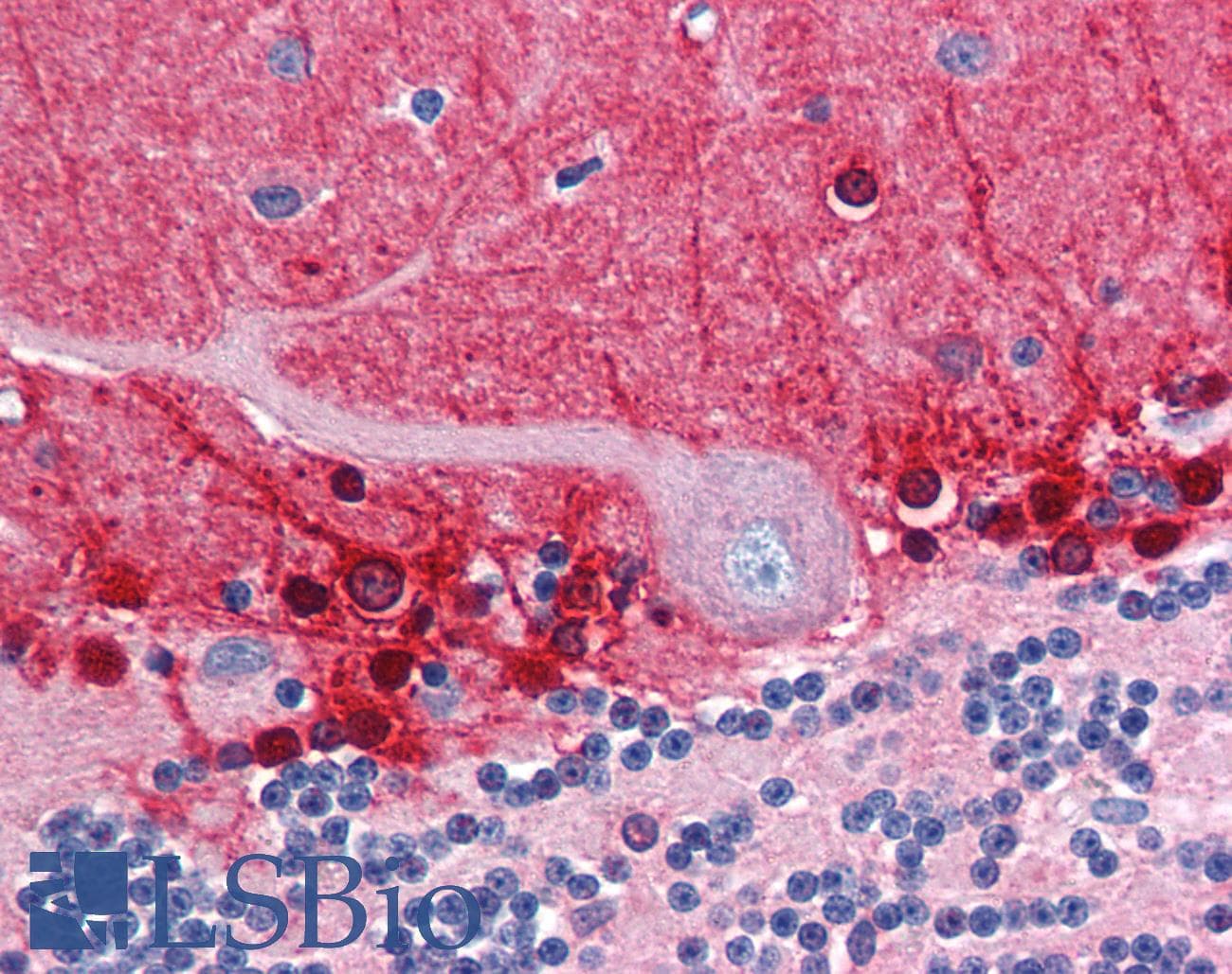 IHC-plus™ Polyclonal Goat anti-Human AMPH / Amphiphysin Antibody (aa159-170, IHC, WB)