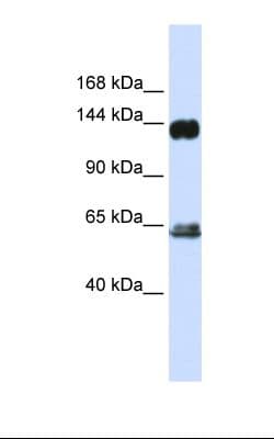 Polyclonal Rabbit anti-Human RAPGEF1 Antibody (aa866-915, IHC, WB)