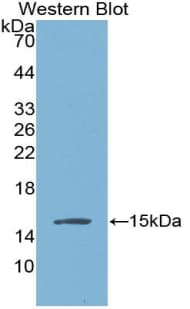VG5Q / AGGF1 Antibody (aa406-501, Cy3)