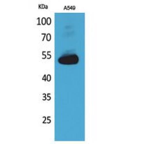 ANXA7 / Annexin VII / SNX Antibody (271-320 aa, Internal)