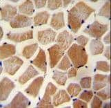 Polyclonal Rabbit anti-Human CCN5 Antibody (aa87-116, IHC, WB)