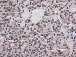 NOTCH1 Antibody (clone OTI4C9)