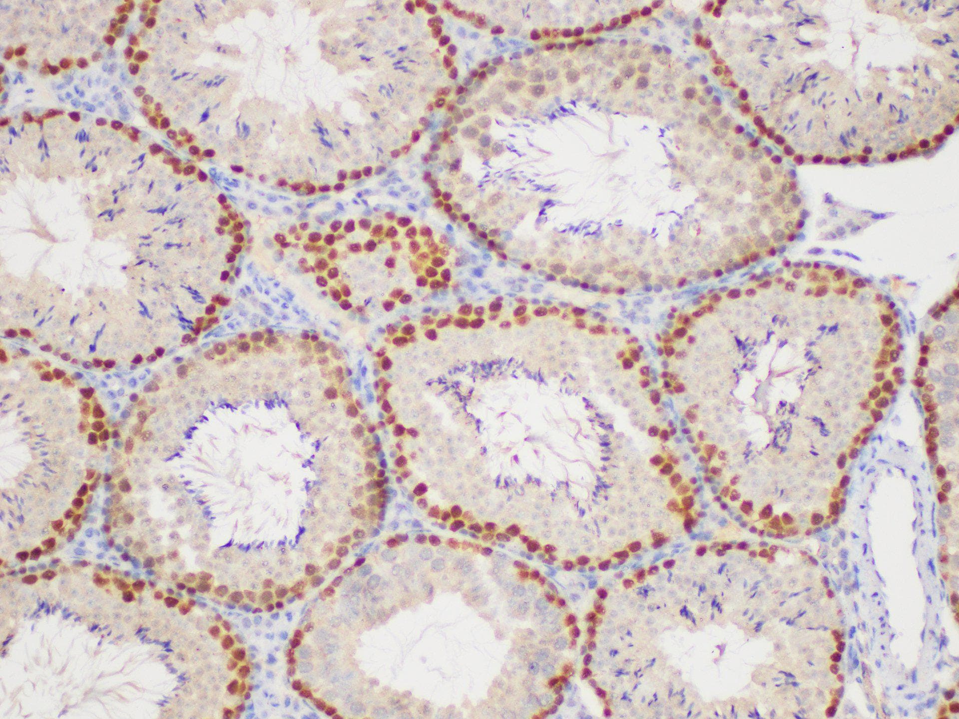 Polyclonal Rabbit anti-Human PCNA Antibody (IHC, WB)