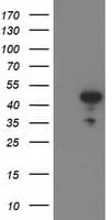 ACY1 / Aminoacylase 1 Antibody (clone OTI1H9, Carrier-free)