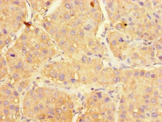 UGP2 Antibody