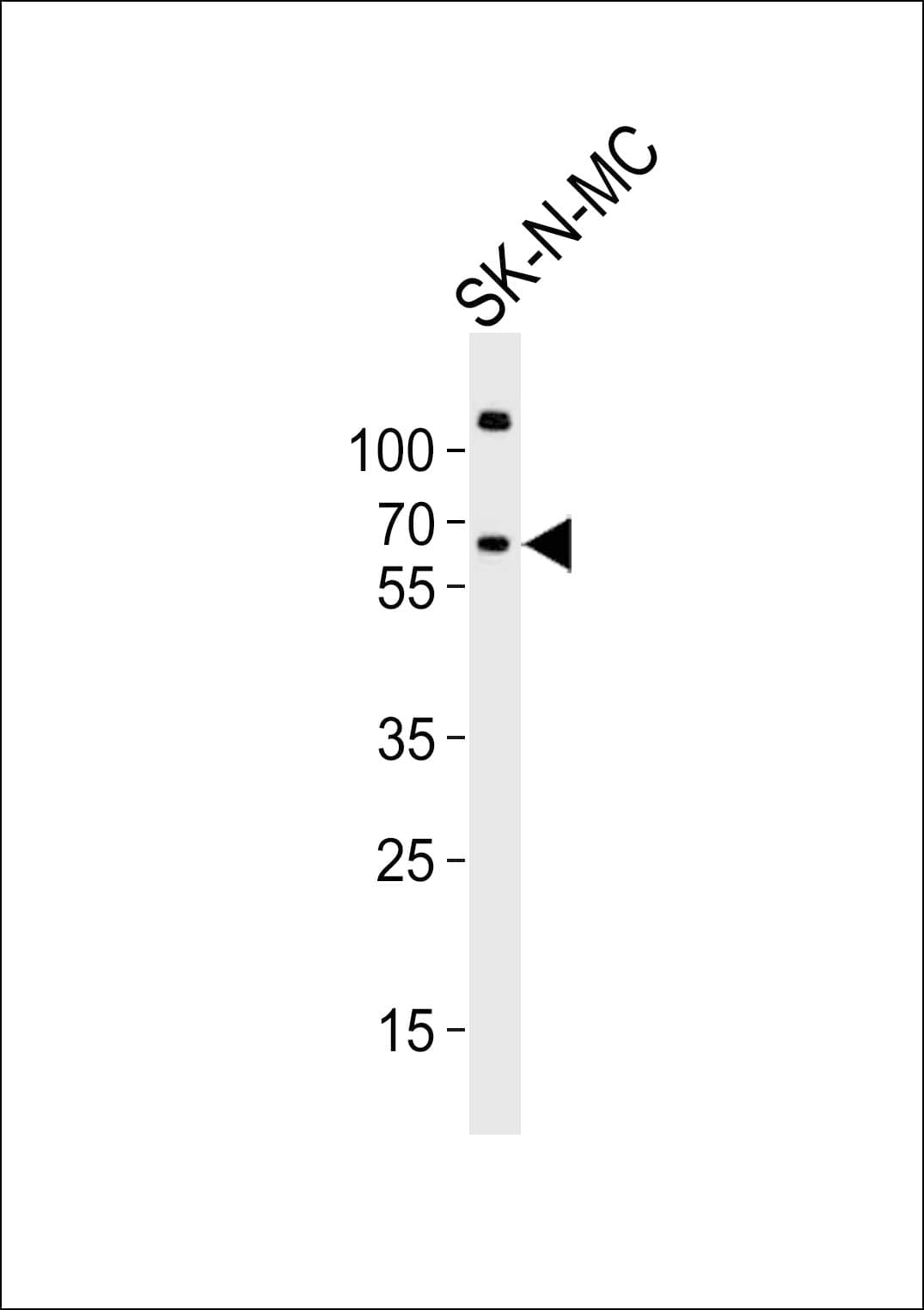 PPP2R5B Antibody (aa466-500)