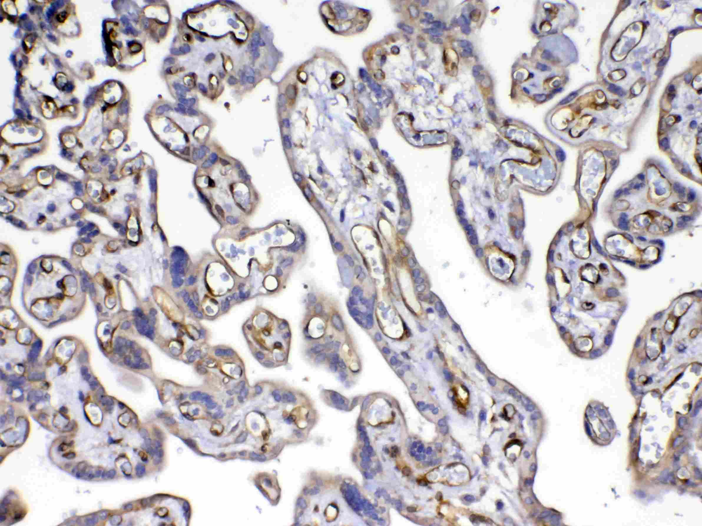Polyclonal Rabbit anti-Human FLT4 / VEGFR3 Antibody (IHC, WB)