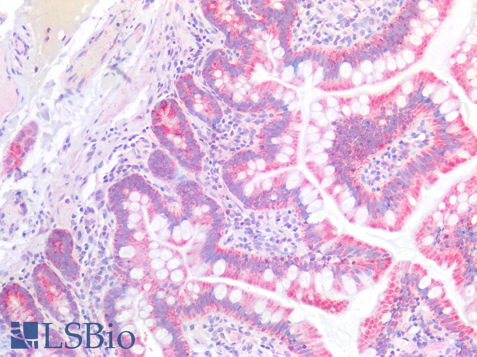PathPlus™ CD157 Antibody