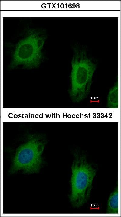 Polyclonal Rabbit anti-Human TTC1 Antibody (aa1-210, WB)