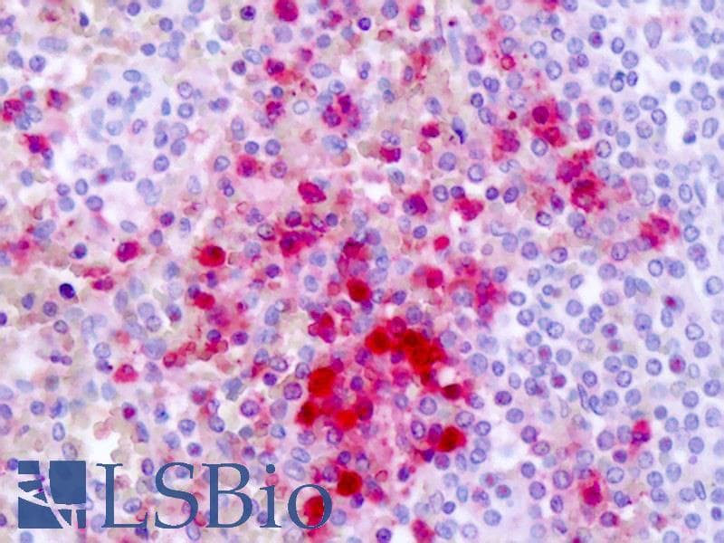 IHC-plus™ GPR161 Antibody (Cytoplasmic Domain)