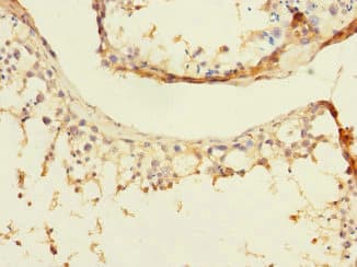Polyclonal Rabbit anti-Human DIAPH2 Antibody (IHC, WB)