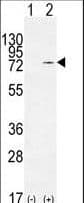 NCL / Nucleolin Antibody (aa428-455)