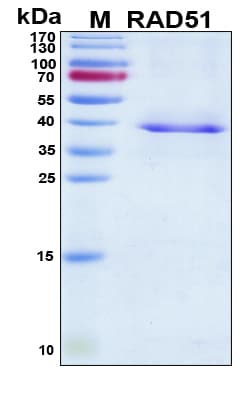 Human RAD51 / RECA Protein (Recombinant His, N-Terminal)