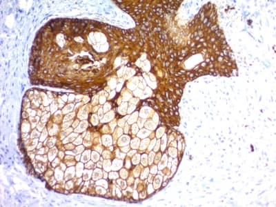 KRT76 + KRT77 Antibody (clone KRTH/1576R + KRTL/1577R)