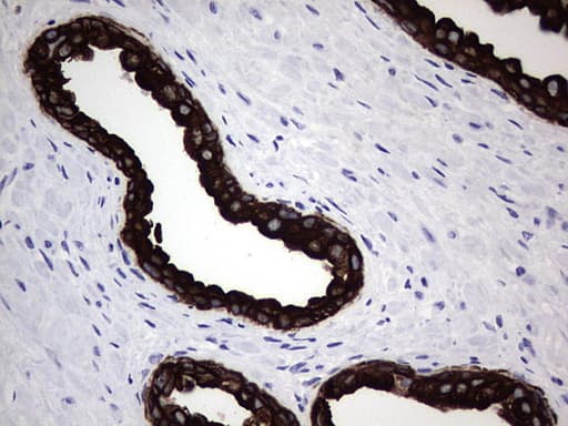 IHC-plus™ Acidic Cytokeratin Antibody (clone 1D10)