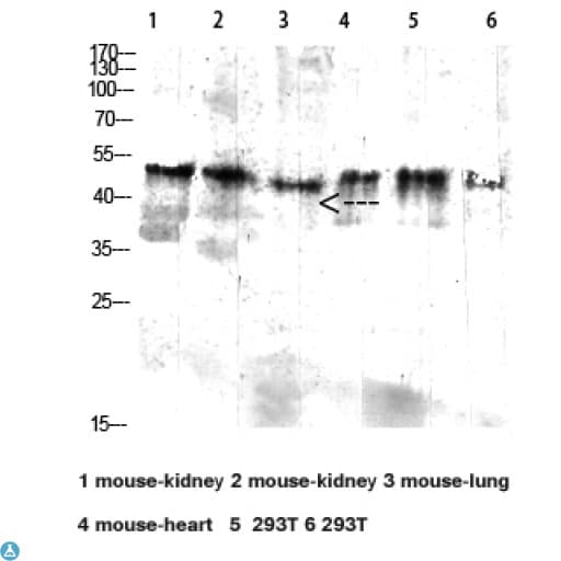 FCGR1A / CD64 Antibody