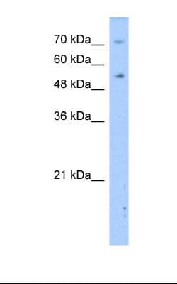 Polyclonal Rabbit anti-Human DPYS / Dihydropyrimidinase Antibody (aa51-100, WB)