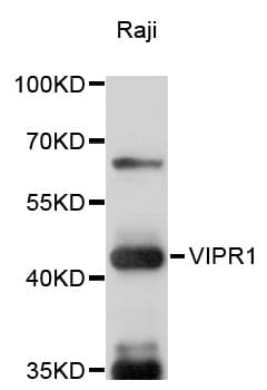 Polyclonal Rabbit anti-Human VIPR1 Antibody (WB)