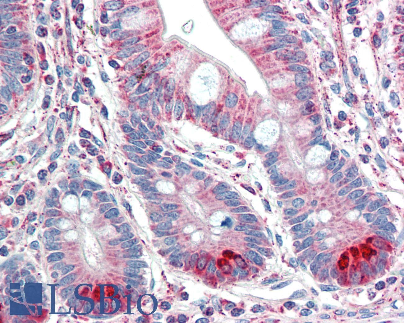 IHC-plus™ TMPRSS5 Antibody (aa413-425)
