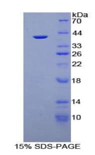 Human Apolipoprotein A-II (Recombinant His-GST)