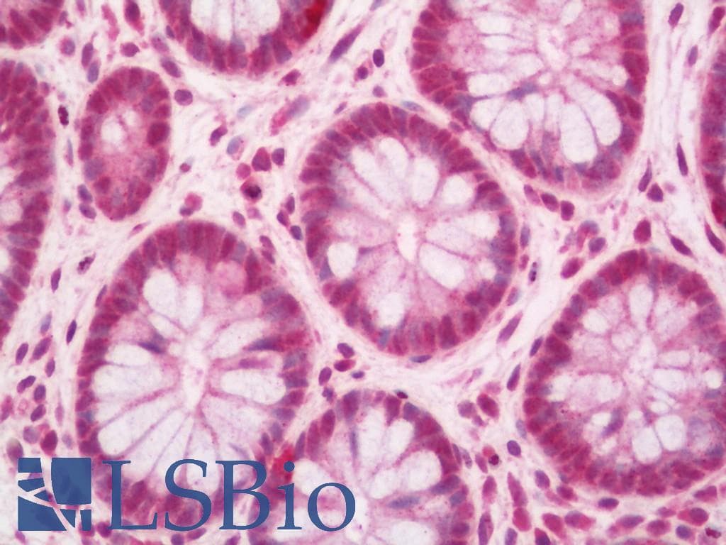 IHC-plus™ SLC29A3 / ENT3 Antibody