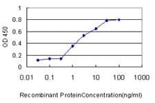 ADD1 / Adducin Alpha Antibody (clone 2C9)