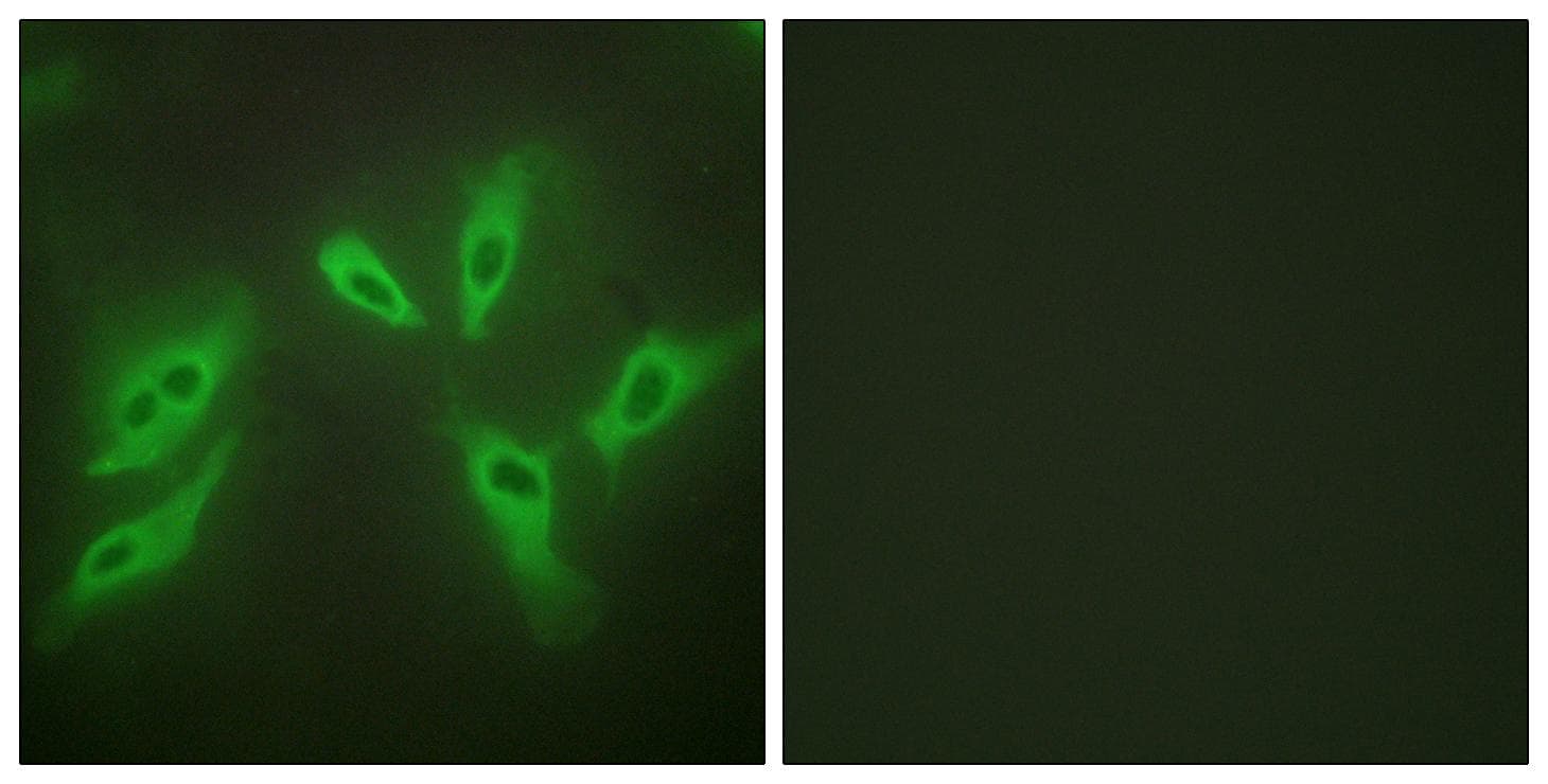 TUSC3 Antibody
