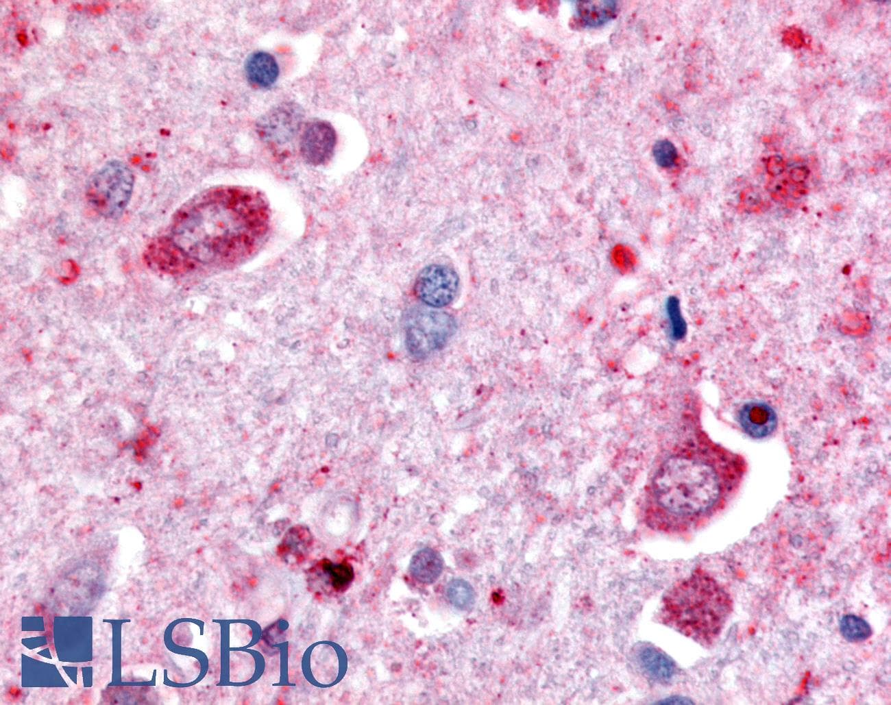 IHC-plus™ DPP6 / Dipeptidylpeptidase 6 Antibody (Extracellular Domain)